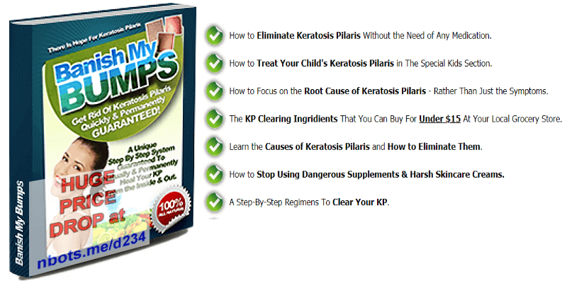 Image of Banish My Bumps Book.