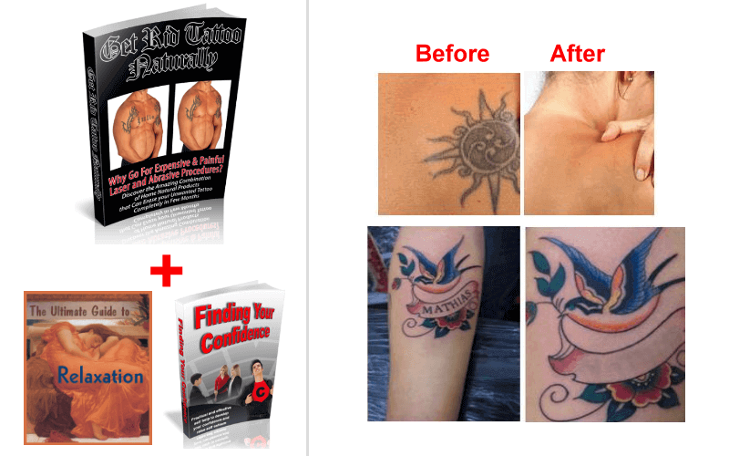 HOW TO GET RID OF TATTOO