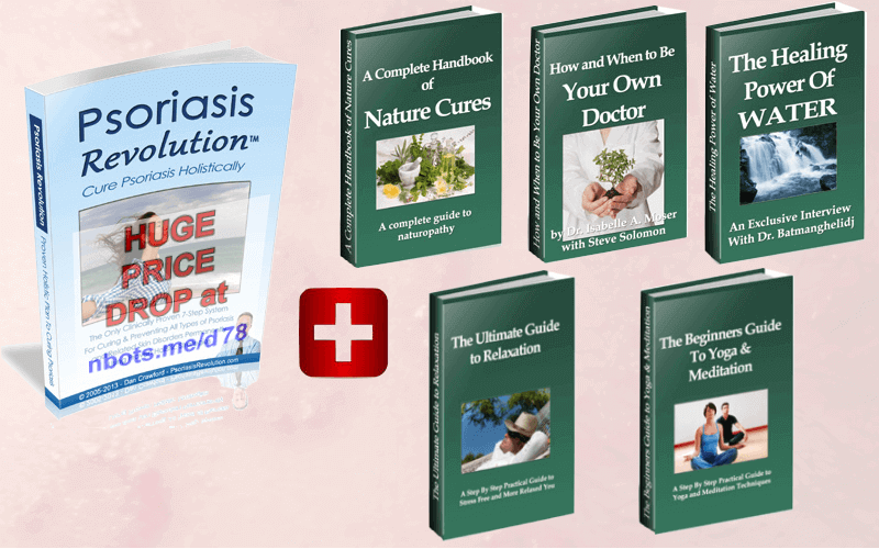 Image of Psoriasis Revolution Ebook Plus Bonus Ebooks Included.