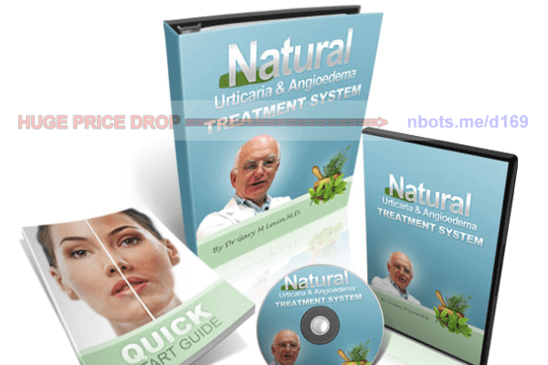 Image of Urticaria and Angioedema Natural Treatment System E-books.